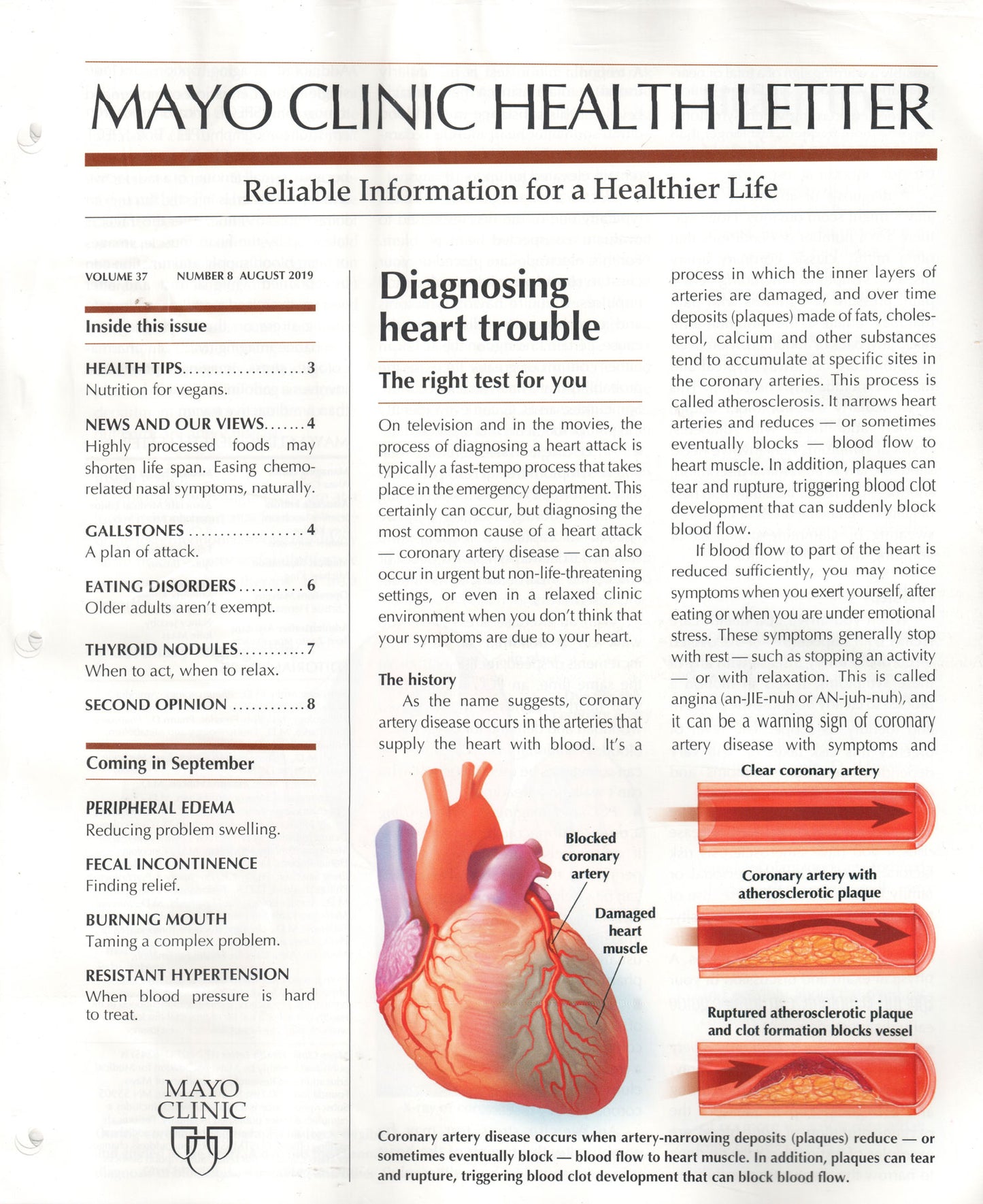 Mayo Clinic Health Letter